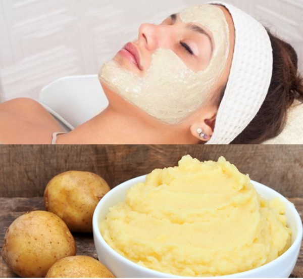 Trị nám bằng khoai tây